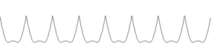 Gefiltertes Nutzsignal